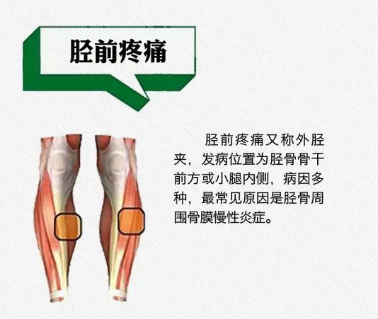 跑步伤病现象早知道